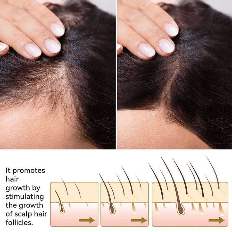Rootroxy™ FEG plus Hair Growth Spray